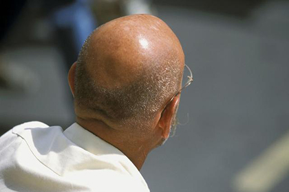 不想变秃头的来看看