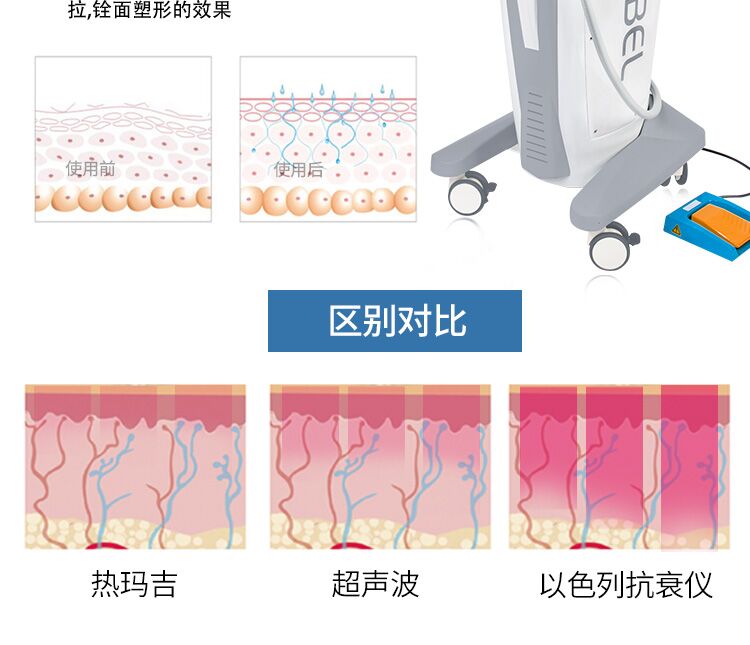 以色列抗衰仪4.jpg