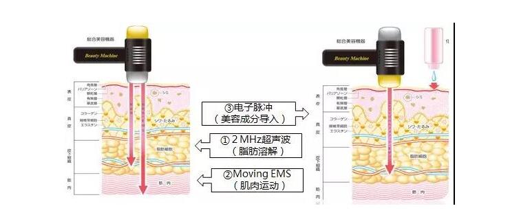 日本专业的美体美颜仪10.jpg