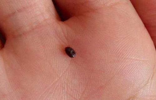 灭跳蚤的有效措施