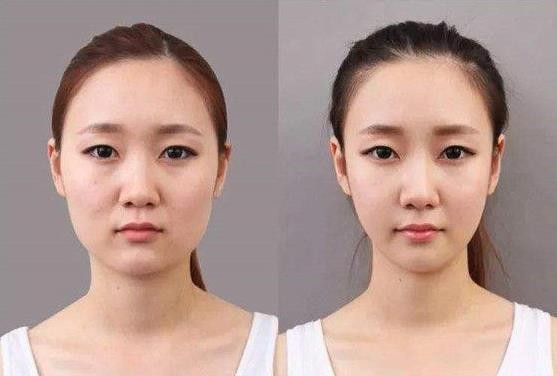 42_产品图片_芒市徒手整形培训,芒市产后修复整形培训,芒市中医针灸